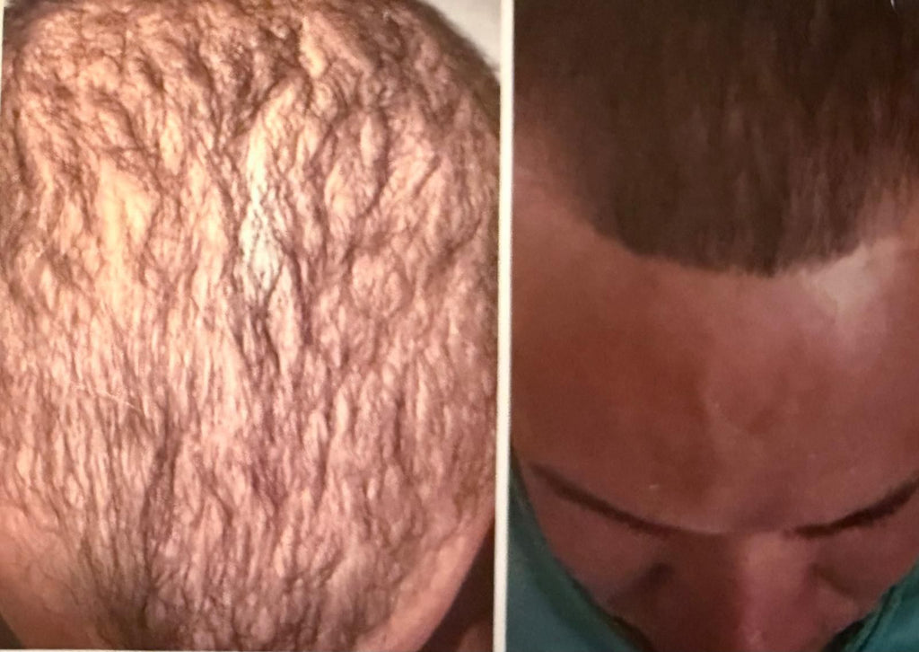 Anti-Hair Loss Growth Dropper | Gotero Anti Caída y Crecimiento
